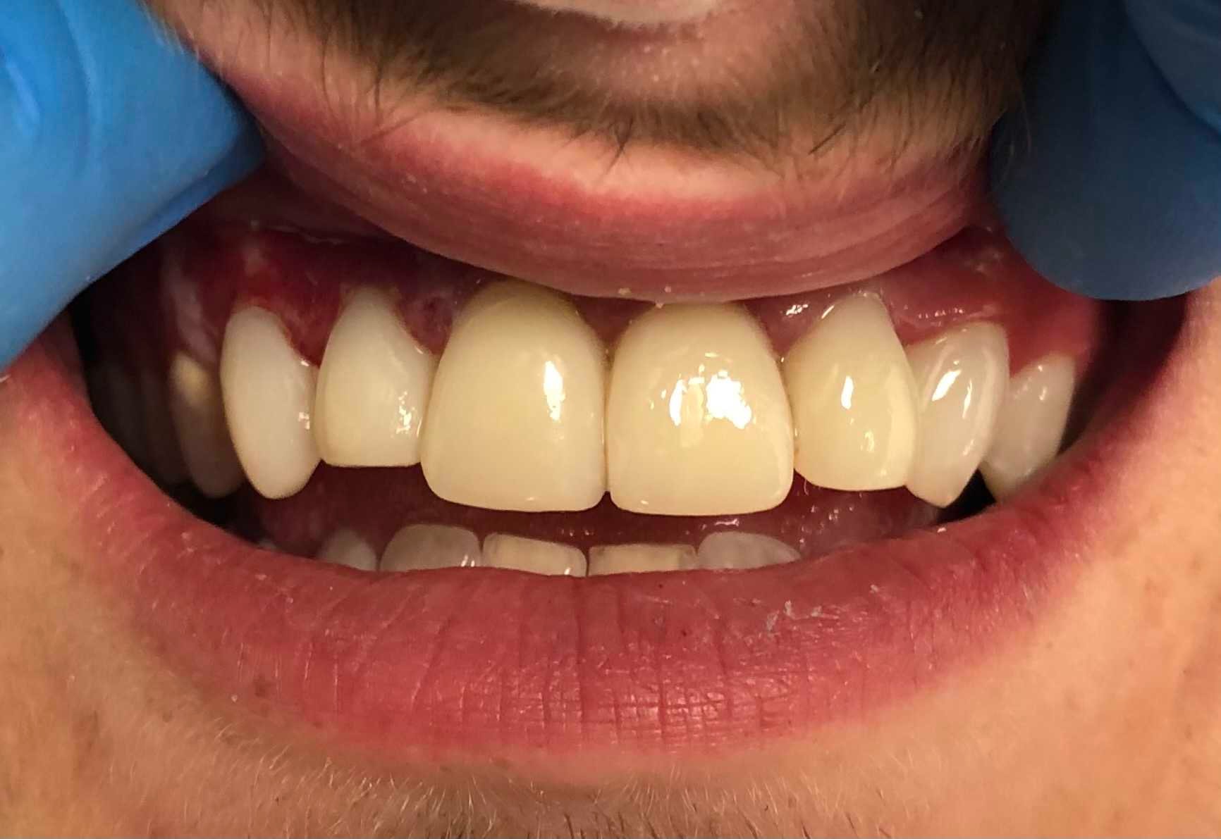 Case 3 after dental treatment