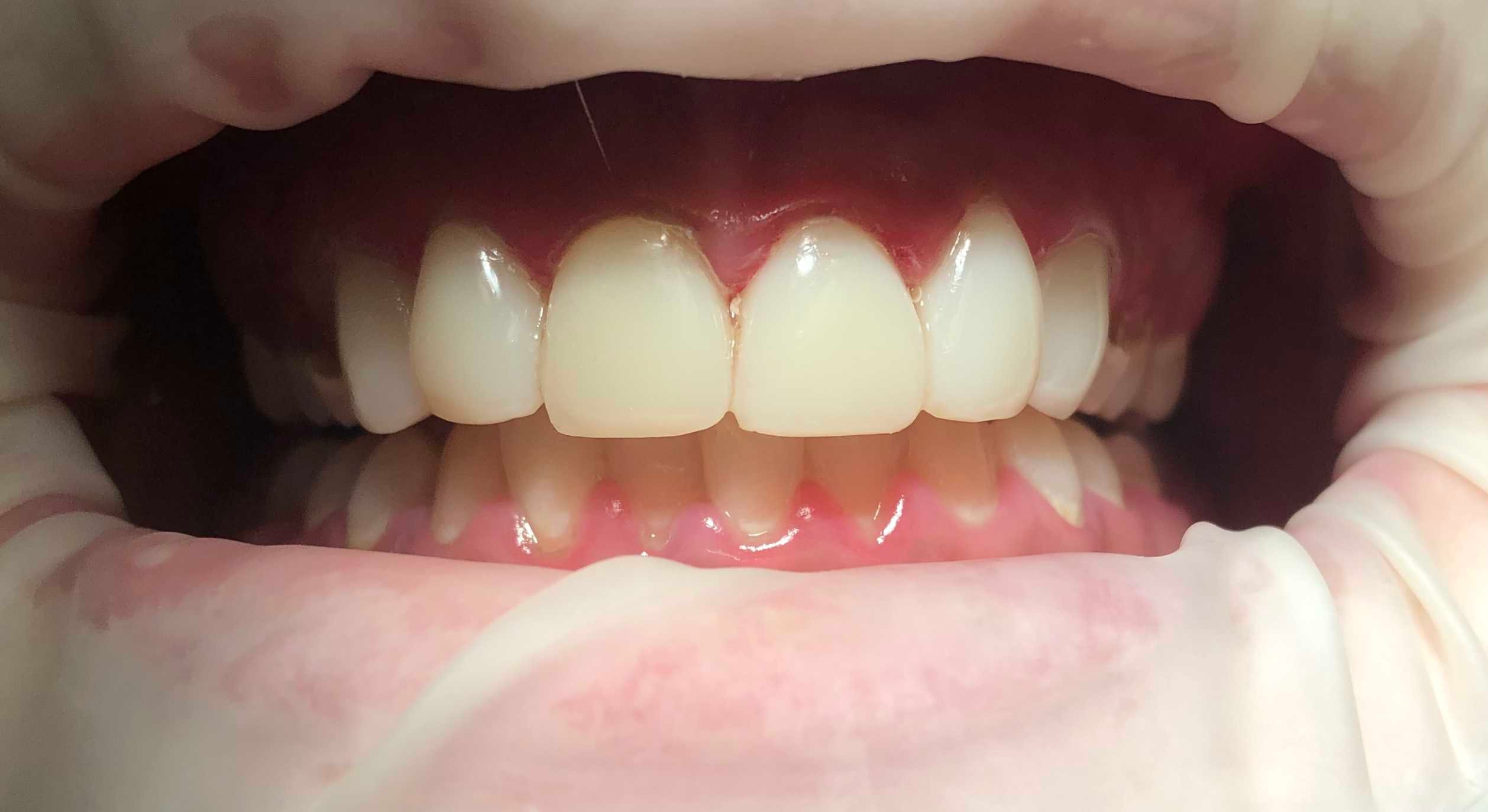 Case 4 after dental treatment